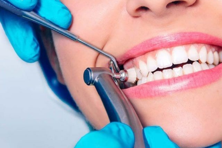 Teeth Cleaning